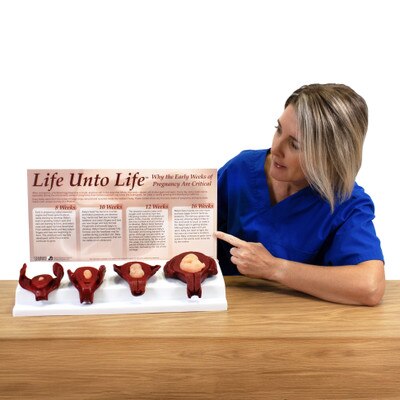 Life Unto Life: The Early Weeks of Pregnancy Display, health education foetal and uterus models, Childbirth Graphics, 22773