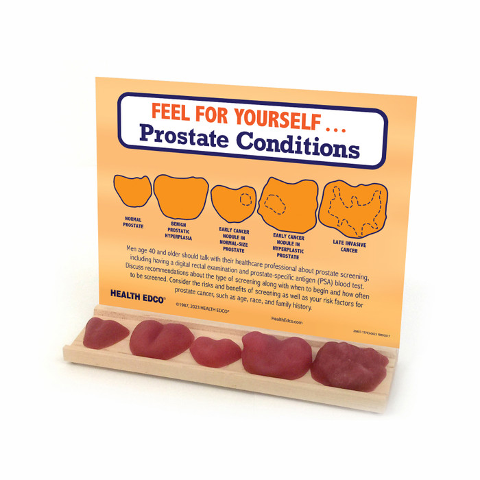Feel for Yourself: Prostate Conditions Display for men's health education from Health Edco with five prostate models, 26807
