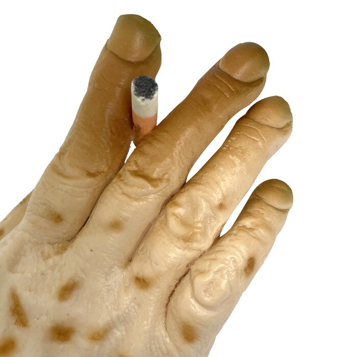 Smoker's Hand: The Death Grip of Nicotine Model, tobacco teaching tool, close-up of smoke-damaged hand, Health Edco, 27034