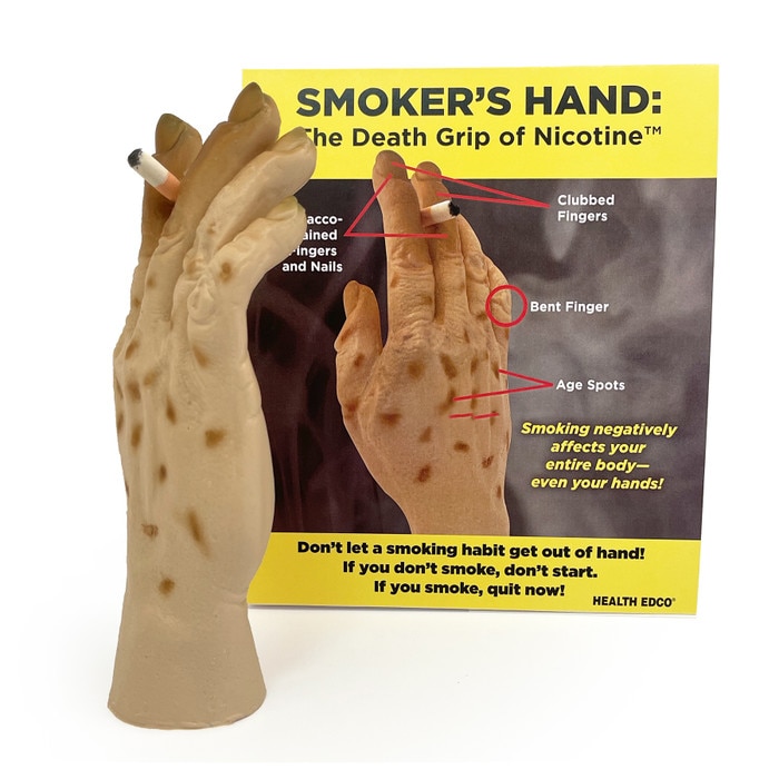 Smoker's Hand: The Death Grip of Nicotine Model, health education tobacco teaching tool with tent card, Health Edco, 27034