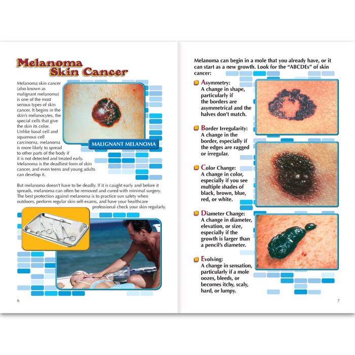 Skin Cancer 16-page booklet inside spread, melanoma skin cancer images, Health Edco, 40071