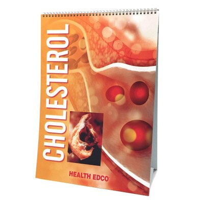 Cholesterol Flip Chart health education resource by Health Edco with six panels and presenter teaching notes, 43117