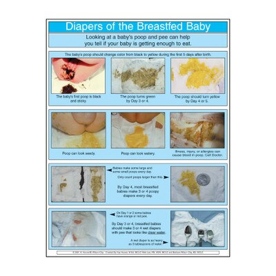 Diapers of the Breastfed Baby full color photo tear pad, colors of breastfed stool, Childbirth Graphics 52741