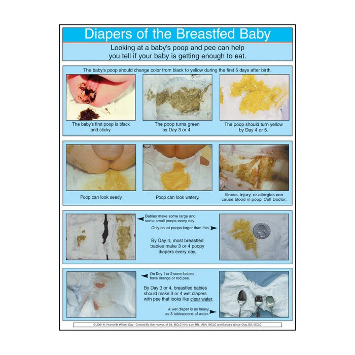 Diapers of the Breastfed Baby full color photo tear pad, colors of breastfed stool, Childbirth Graphics 52741