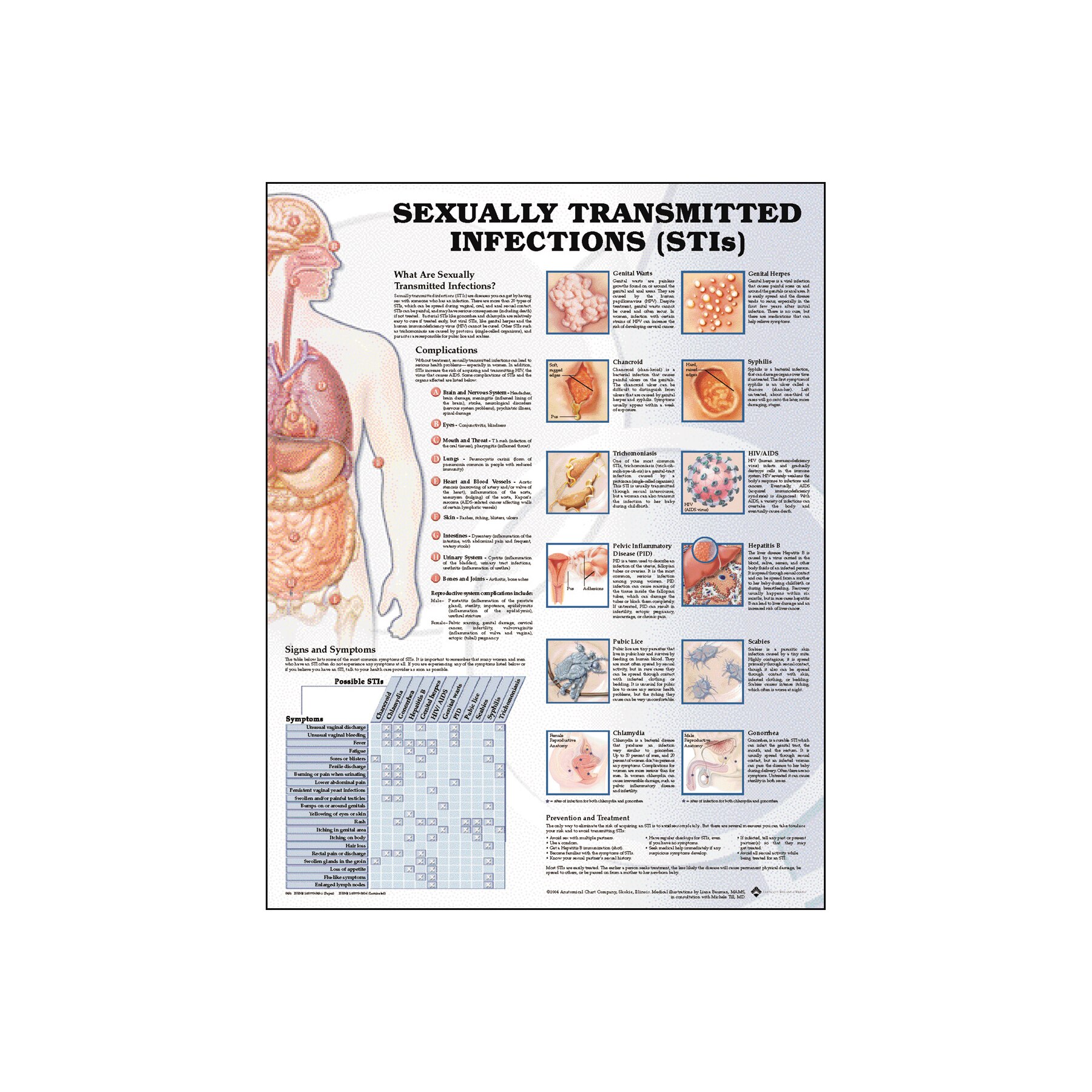 Sexually Transmitted Infections Chart