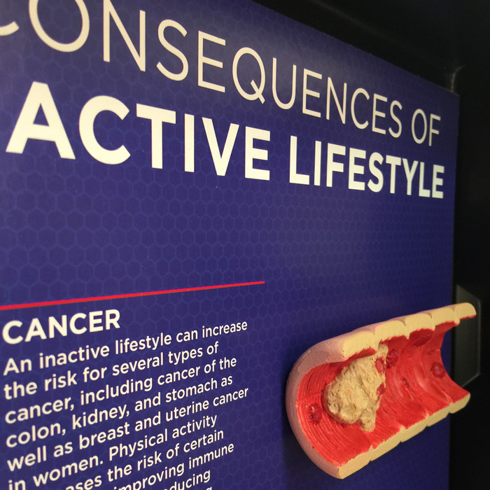Inactive Lifestyle Consequences 3-D Display by Health Edco, educational colon cancer model from a sedentary lifestyle, 78854