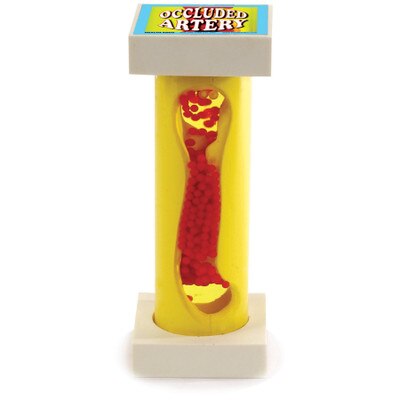 Occluded Artery Model for health education, heart health education models, atherosclerosis model, Health Edco, 79145