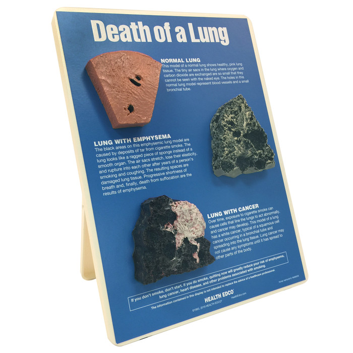Death of a Lung educational easel display from Health Edco with models of a normal, emphysematous, and cancerous lung, 79148
