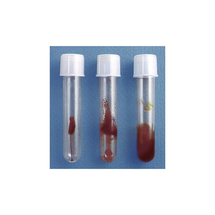 Smokey Sue Display, health education display test tubes to collect cigarette smoke tar for visualisation, Health Edco, 79206