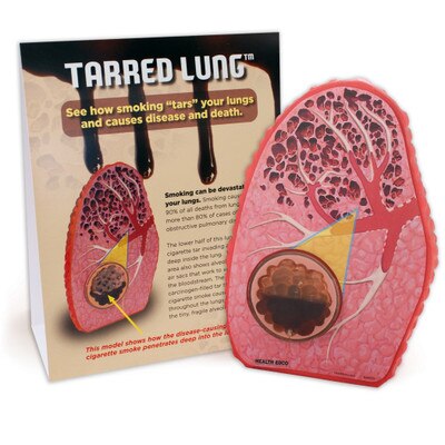 Tarred Lung Model, health education lung model to deter smoking with educational tent card, Health Edco teaching tools, 79234