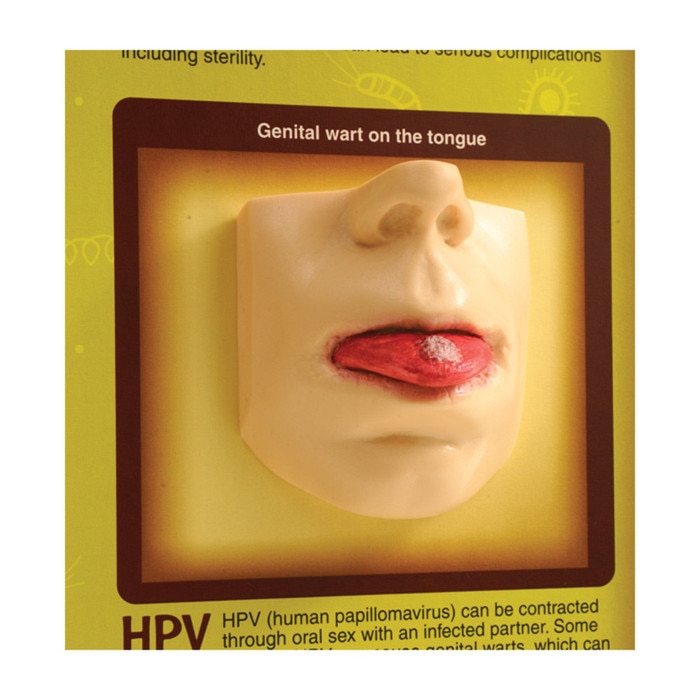 Best of Health risks from oral sex Big breasts large nipples