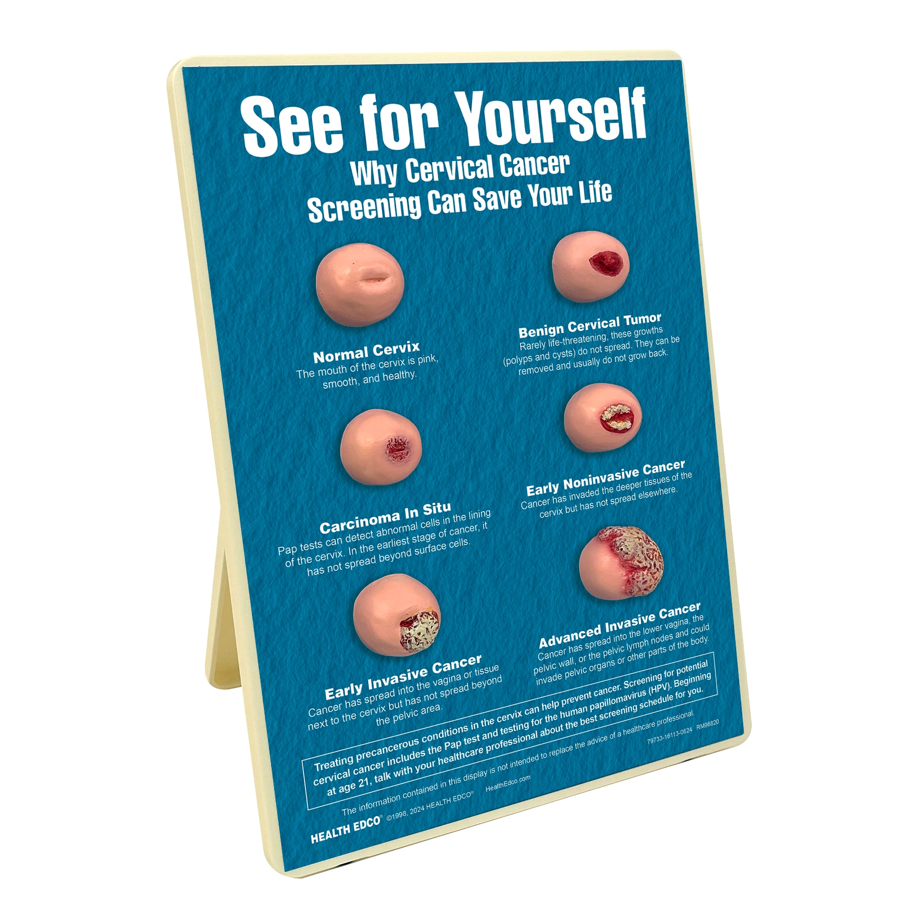 home remedies for hpv on cervix