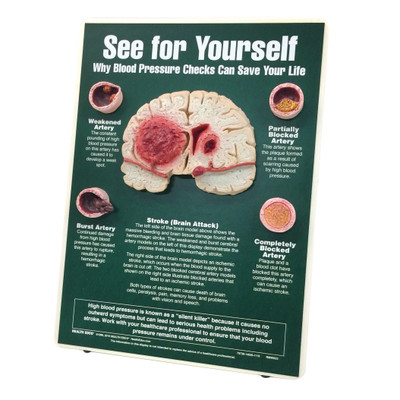 See for Yourself Blood Pressure Checks Easel Display for health education by Health Edco with brain and artery models, 79736