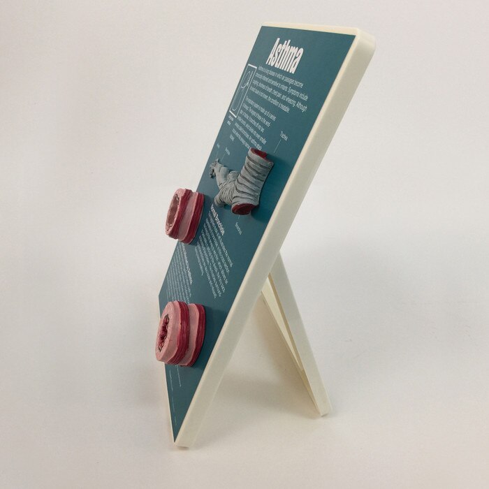 Asthma Easel Display For Health Education Health Edco