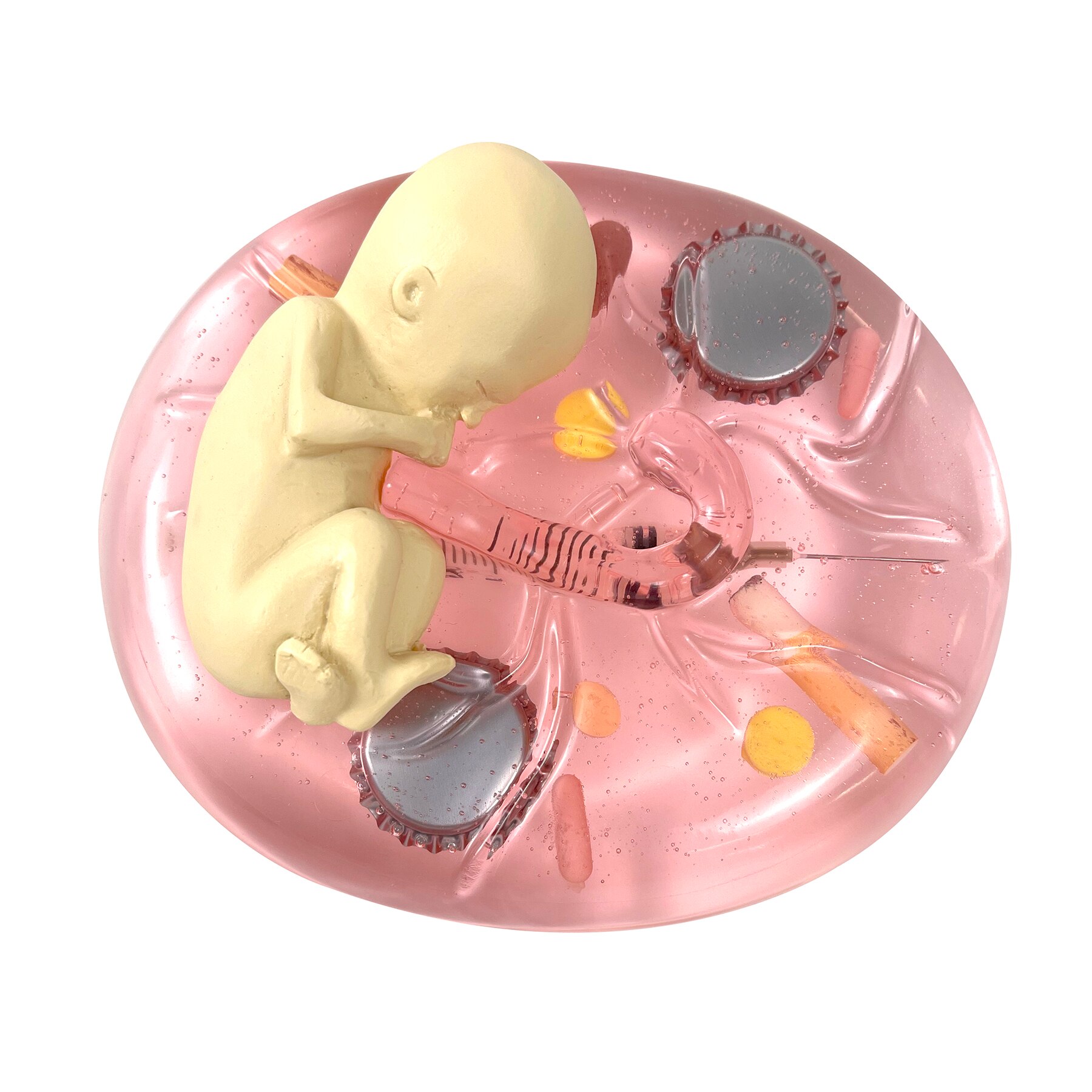 Educational Drug Use In Pregnancy Model Health Edco