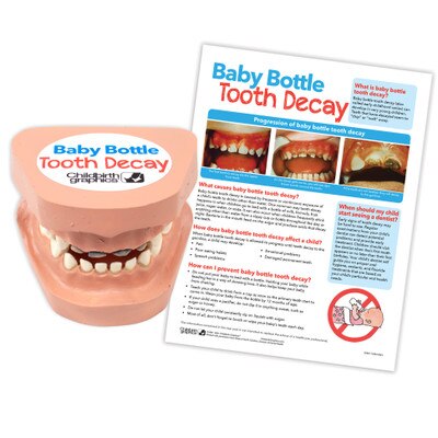 Baby Bottle Tooth Decay Model Set, toddler tooth decay model with parenting education leaflet, Childbirth Graphics, 79865