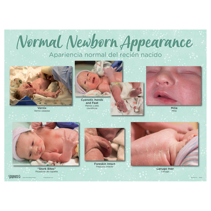 Normal Newborn Appearance Chart of the Newborn Chart Set by Childbirth Graphics for new parent and education, 90160