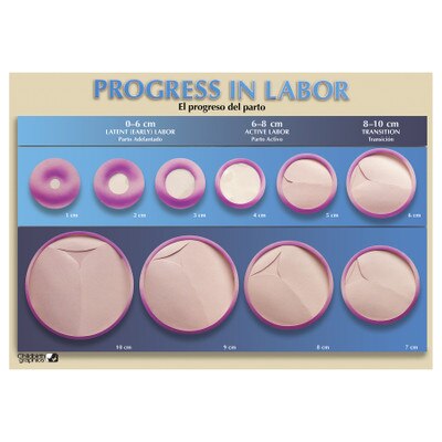 Educational Progress In Labor Chart | Childbirth Graphics